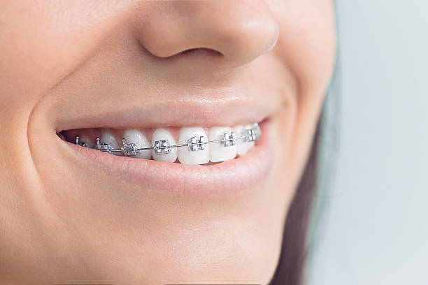 Why Choose Us for Your Dental Needs in Winter Park, FL